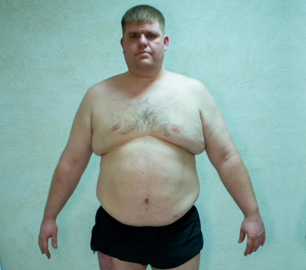 145 килограммов весит автослесарь Александр Иванов – второй участник реалити-шоу «Сбросить лишнее»