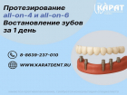 Имплантация All-on-4 и All-on-6