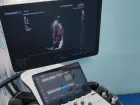 Современный УЗИ-аппарат экспертного класса начал свою работу в детской больнице 