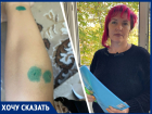 Болезненные уколы от бешенства: 14-летняя школьница стала жертвой агрессивной собаки и равнодушных хозяев