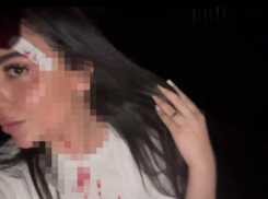 Журналистку «Блокнота» избила роликовыми коньками цыганка, держа ребенка в одной руке