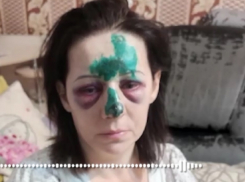 Не за брата, а за телефон: почему волгодончанка вцепилась в полицейский автомобиль