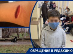 Рваная рана и дикий испуг: ребенка погрызли собаки неподалеку от администрации Волгодонска