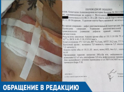 Во время операции по удалению кисты 20-летней волгодончанке повредили прямую кишку
