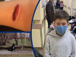 Следователи проводят проверку по факту нападения собаки на 11-летнего мальчика в Волгодонске