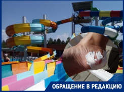 «Экстремальная база отдыха»: волгодонец рассказал, как покалечился на «Донской волне»