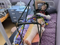 51 день юноша был прикован к постели: в Волгодонске лишили прав водителя «Ауди», который на огромной скорости сбил подростка 