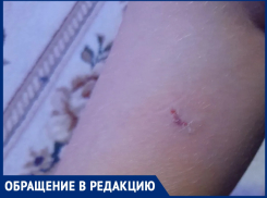 «Бродячие псы напали на сына и прокусили ногу»: мама школьника просить очистить улицы Волгодонска от четвероногой опасности