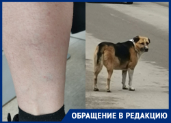 «Повезло не прокусила, а если ребенок?»: собака два раза укусила женщину за ногу на 30 лет Победы