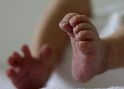 Волгодонские медики спасли жизнь трехлетнего малыша, получившего 40-процентные ожоги поверхности тела