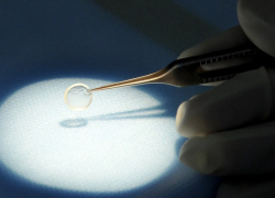 Ростовские врачи вернули зрение жительнице Волгодонска, пострадавшей от контактных линз