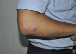 В Волгодонске пьяная администратор сауны укусила полицейского во время задержания