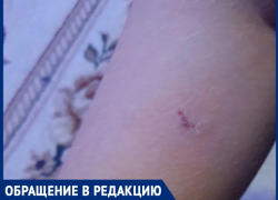 «Бродячие псы напали на сына и прокусили ногу»: мама школьника просить очистить улицы Волгодонска от четвероногой опасности