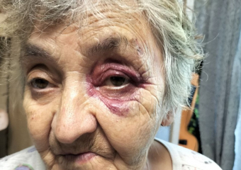 Подростки на электросамокате сбили в Волгодонске 76-летнюю пенсионерку и наблюдали за ее мучениями 