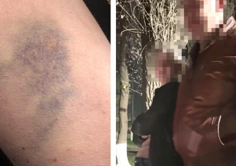 Пьяная чиновница и военный избили двух девушек за претензии к громкой музыке: жители Морозовска 