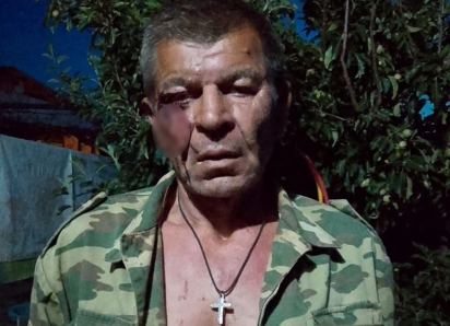 Дети мигрантов из Средней Азии безнаказанно избили толпой пенсионера: жители хутора в Ростовской области просят защиты у Бастрыкина