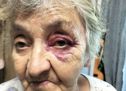 Подростки на электросамокате сбили в Волгодонске 76-летнюю пенсионерку и наблюдали за ее мучениями 