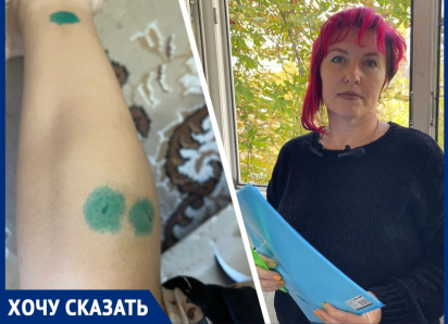 Болезненные уколы от бешенства: 14-летняя школьница стала жертвой агрессивной собаки и равнодушных хозяев