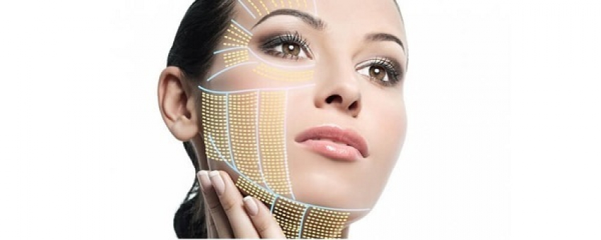 Hifu smas* лифтинг или омоложение лица в Израиле путем инновационных технологий