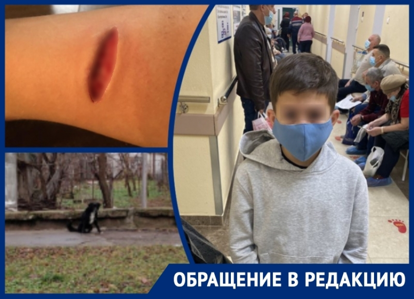 Рваная рана и дикий испуг: ребенка погрызли собаки неподалеку от администрации Волгодонска