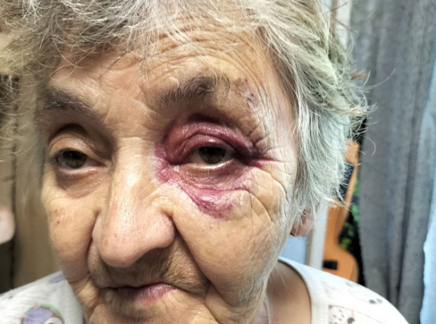 Подростки на электросамокате сбили в Волгодонске 76-летнюю пенсионерку и наблюдали за ее мучениями 