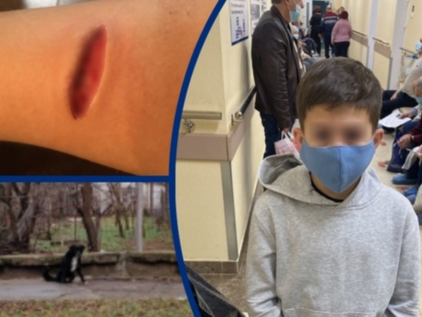 Следователи проводят проверку по факту нападения собаки на 11-летнего мальчика в Волгодонске