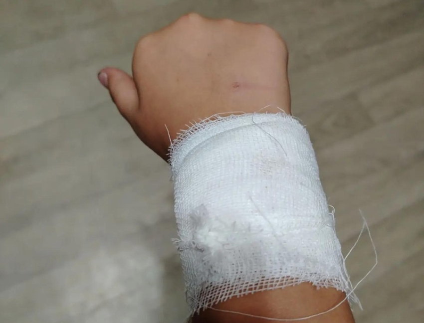 Бездомная собака напала на 8-летнюю девочку на улице Горького