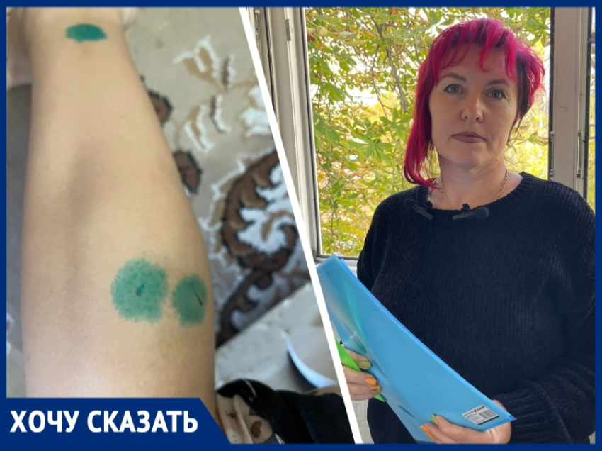 Болезненные уколы от бешенства: 14-летняя школьница стала жертвой агрессивной собаки и равнодушных хозяев