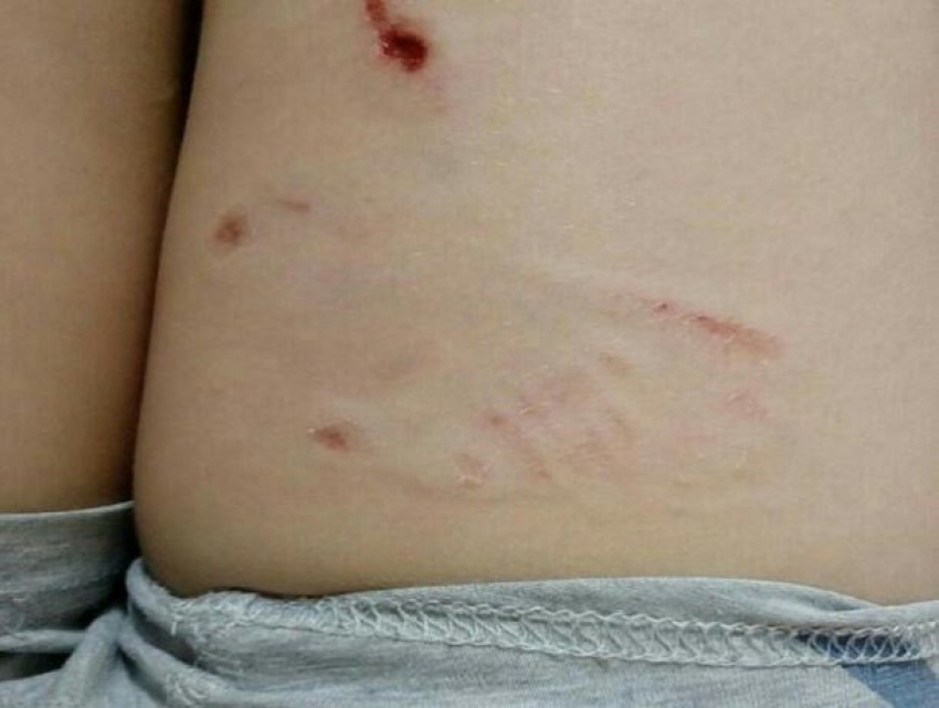 Бездомные собаки искусали до крови 7-летнего ребенка в Волгодонске, - читатель