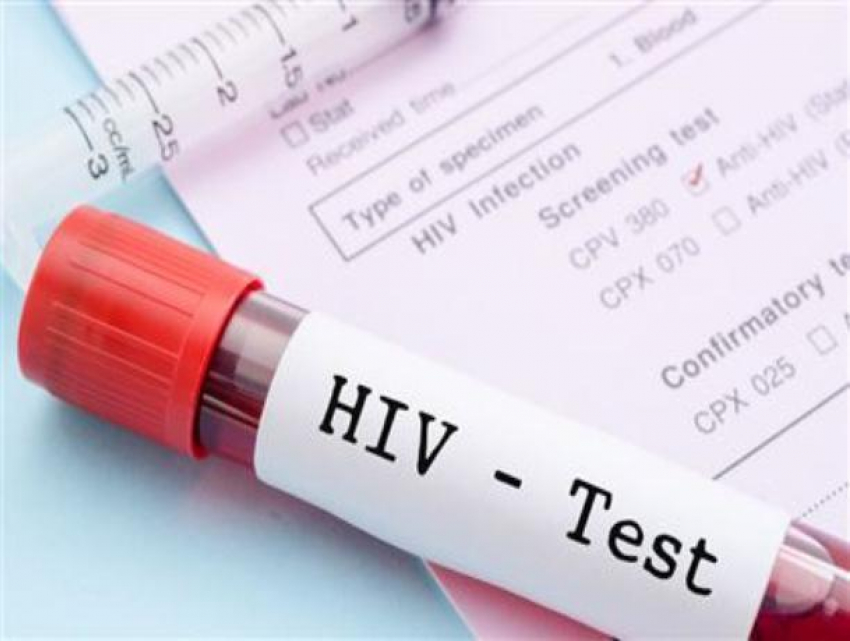 34 новых случая ВИЧ-инфекции выявлено у жителей Волгодонска