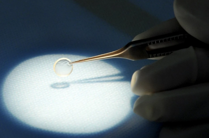 Ростовские врачи вернули зрение жительнице Волгодонска, пострадавшей от контактных линз