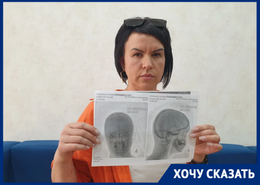 «Я боюсь, что она может облить меня кислотой!»: агрессивная парикмахерша избила женщину в Цимлянске  