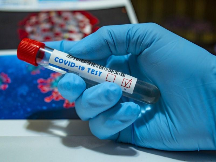 Восемь человек в Волгодонске пополнили ряды больных коронавирусом за сутки