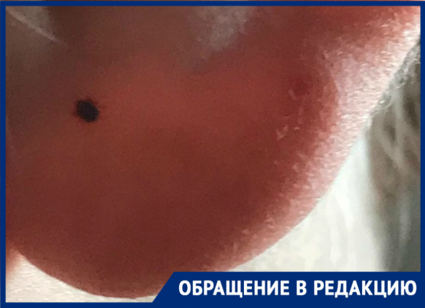 «Это что нашествие?»: волгодончанка за один день сняла несколько клещей со своих двоих детей
